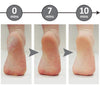 FeetCleanse™ | Alltid myke føtter